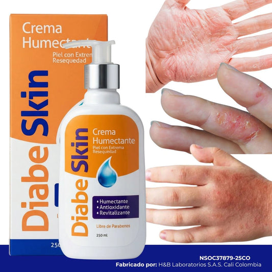 Diabeskin - Crema humectante para Dermatitis