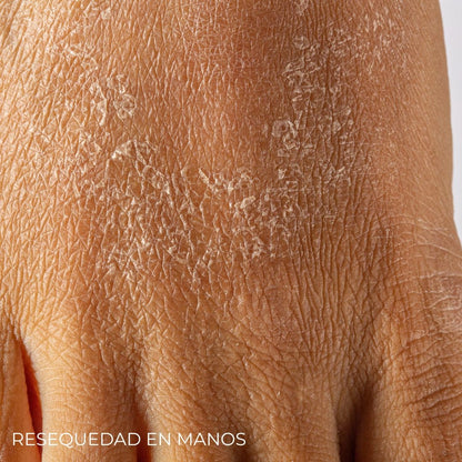 Diabeskin - Crema humectante para La Resequedad