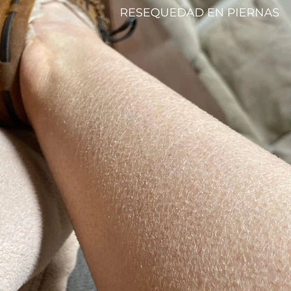 Diabeskin - Crema humectante para La Resequedad