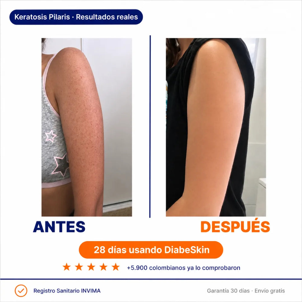 DiabeSkin Ultrahumectante