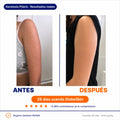 DiabeSkin - Ultrahumectante