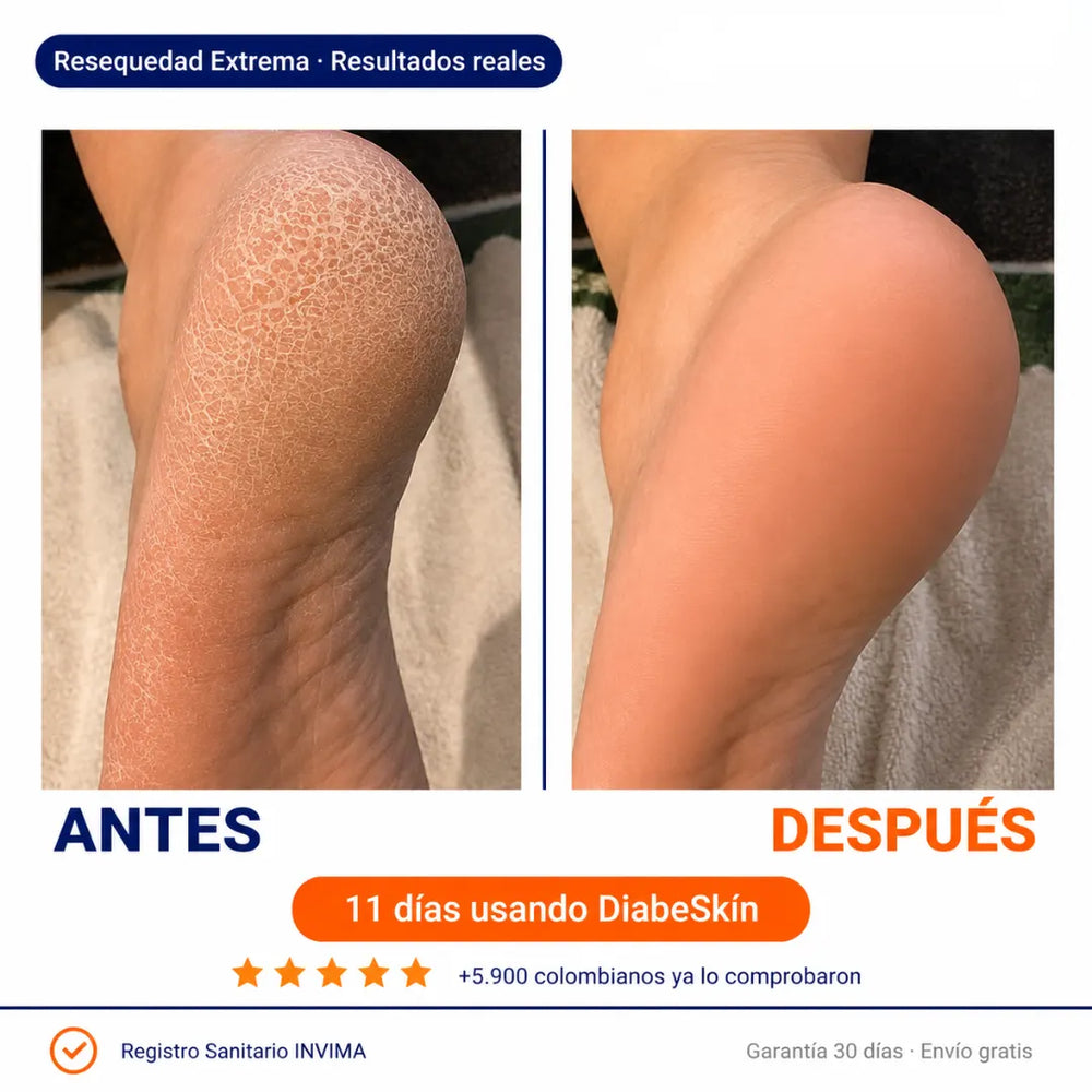 DiabeSkin Ultrahumectante