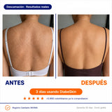 DiabeSkin Ultrahumectante