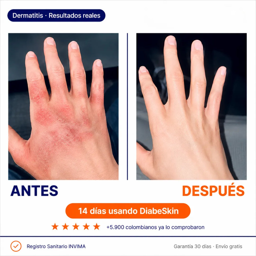 DiabeSkin Ultrahumectante