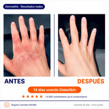 DiabeSkin Ultrahumectante