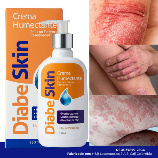 Diabeskin - Crema humectante para Psoriasis