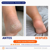 Kit Edición Amor y Amistad |
